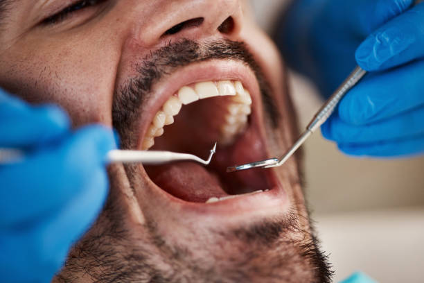 Best Emergency Treatment for Dental Infections or Abscesses in Erath, LA
