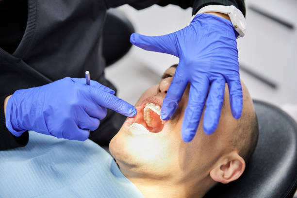 Best Emergency Gum Treatment in Erath, LA