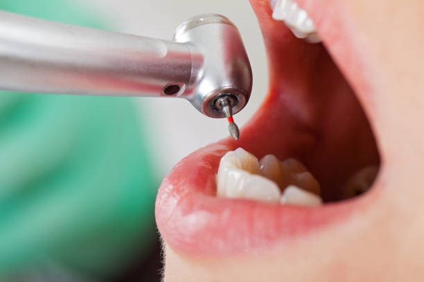 Best Emergency Denture Repair in Erath, LA